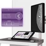 HOLOGIC® - Mammography Software Upgrades - Mammography